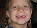 Analesse shows off her missing front teeth.  During their stay in Austin, Lesse's remaining front tooth was irrating her enough that she wanted the tooth/string/front-door procedure.  Mother Ann performed the procedure flawlessly.